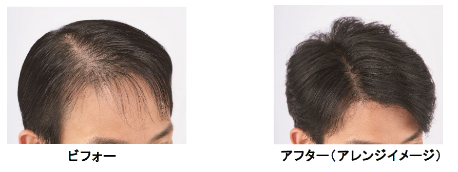 booster_BAF.png