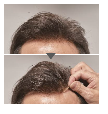 hair_system.png
